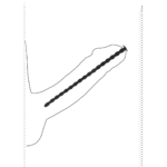 Urethrale toy met diverse diameters – Geavanceerd - Afbeelding 4