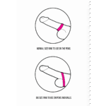 Niet-vibrerende cockring met twisty design – Groot Medium - Afbeelding 6